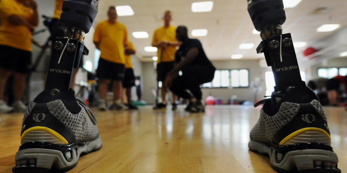 101005-N-2055M-357
SAN DIEGO (Oct. 5, 2010) Navy volunteers are framed between the prosthetic legs of a Paralympic Military Sports Camp participant at Balboa Naval Medical Center. Paralympic Military Sports Camps are multi-day events to introduce veterans and military personnel with physical injuries to a variety of summer and winter sport opportunities. (U.S. Navy photo by Mass Communication Specialist 3rd Class Travis K. Mendoza/Released)